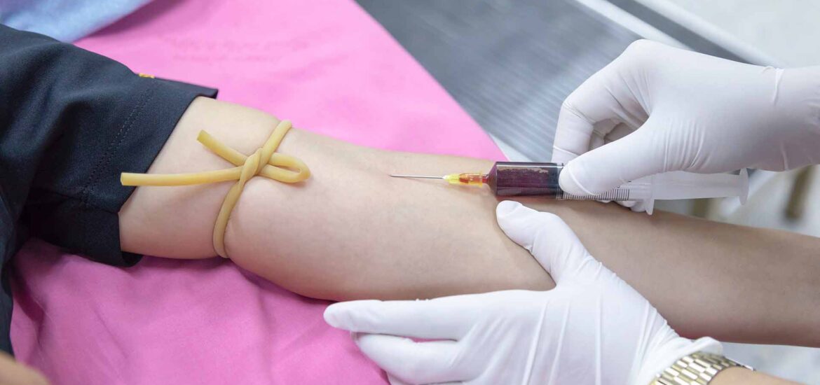 Sweden’s Blood Bank Texts You Whenever your Blood Saves a Life